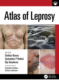 Atlas of Leprosy