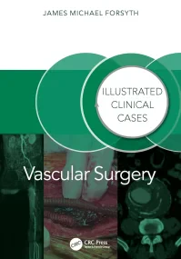 Vascular Surgery: Illustrated Clinical Cases