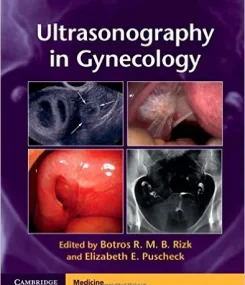 Ultrasonography in Gynecology