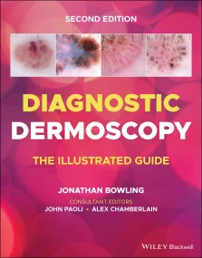 Diagnostic Dermoscopy &#150; The Illustrated Guide...