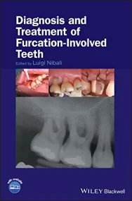 Diagnosis and Treatment of Furcation-Involved Teet...