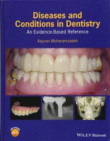 Diseases and Conditions in Dentistry: An Evidence&...