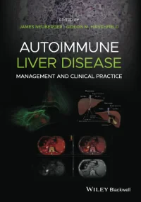 Autoimmune Liver Disease: Management and Clinical ...
