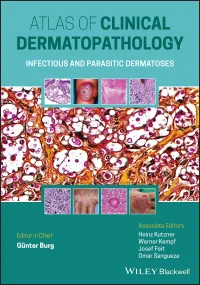 Atlas of Clinical Dermatopathology: Infectious and...