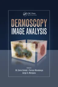 Dermoscopy Image Analysis