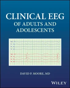 Clinical EEG of Adults and Adolescents 1st Edition