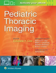 Pediatric Thoracic Imaging