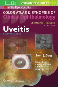 Uveitis (Color Atlas & Synopsis of Clinical Ophtha...