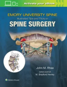 Emory&#146;s Illustrated Tips and Tricks in Spine ...