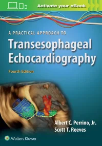 A Practical Approach to Transesophageal Echocardio...