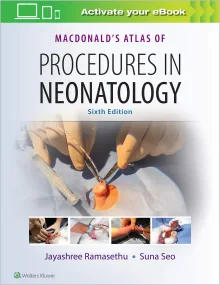 MacDonald&#146;s Atlas of Procedures in Neonatolog...
