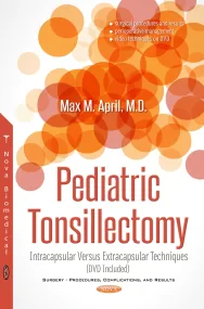 Pediatric Tonsillectomy: Intracapsular Versus Extr...