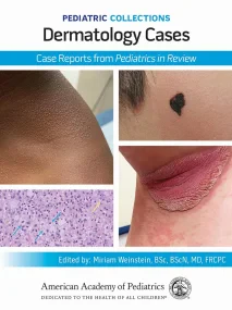 Pediatric Collections: Dermatology Cases