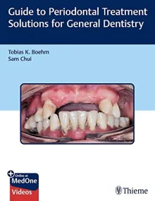 Guide to Periodontal Treatment Solutions for Gener...