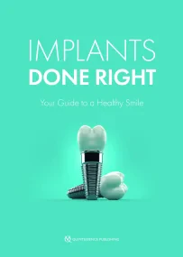 Implants Done Right: Your Guide to a Healthy Smile