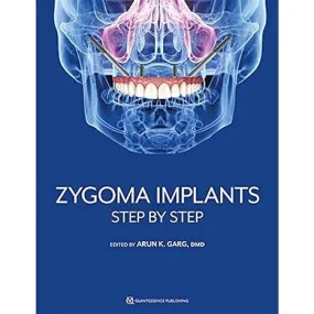 Zygoma Implants: Step by Step