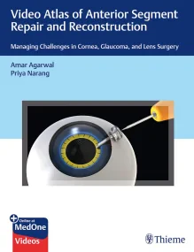 Video Atlas of Anterior Segment Repair and Reconst...