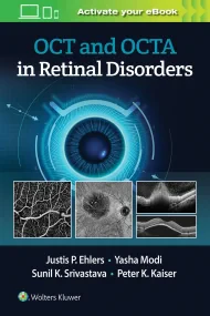 OCT and OCTA Angiography in Retinal Disorders