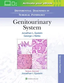 Differential Diagnoses in Surgical Pathology: Geni...