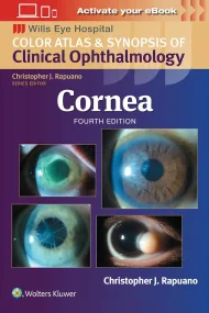 Cornea: Print + Digital with Multimedia (Wills Eye...