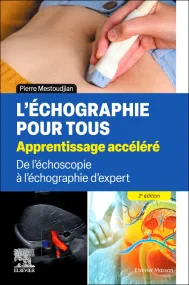 L'échographie pour tous : apprentissage accéléré