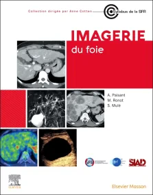 Imagerie du foie