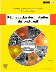 Rétine : atlas des maladies du fond d'oeil