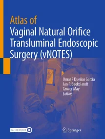 Atlas of Vaginal Natural Orifice Transluminal Endo...