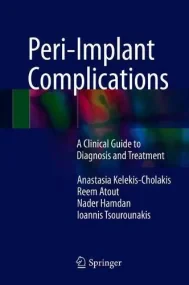 Peri-Implant Complications: A Clinical Guide to Di...