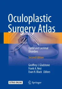 Oculoplastic Surgery Atlas: Eyelid and Lacrimal Di...