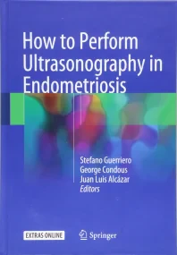How to Perform Ultrasonography in Endometriosis