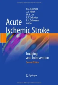 Acute Ischemic Stroke: Imaging and Intervention