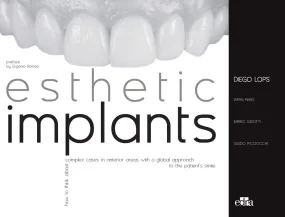Esthetic Implants - 2 books