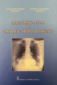Diagnostic atlas of thoracic hydatid disease