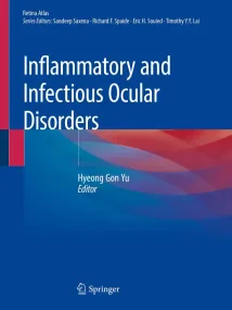 Inflammatory and Infectious Ocular Disorders (Reti...