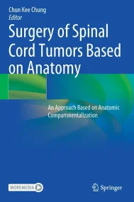 Surgery of Spinal Cord Tumors Based on Anatomy
