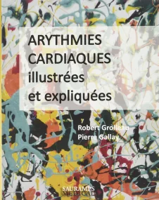 ARYTHMIES CARDIAQUES ILLUSTREES ET EXPLIQUEES