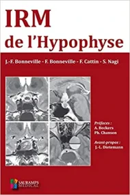 IRM DE L'HYPOPHYSE