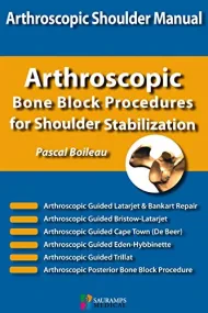 ARTHROSCOPIC BONE BLOCK PROCEDURES FOR SHOULDER ST...