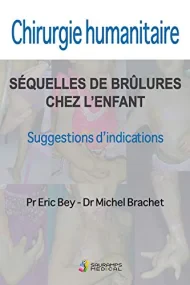 CHIRURGIE HUMANITAIRE. SEQUELLES DE BRULURES CHEZ ...